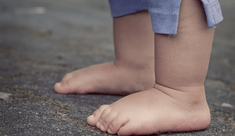 Intoxicación Infantil: Niña de Dos Años Ingresada en Hospital de&nbsp;Rivera